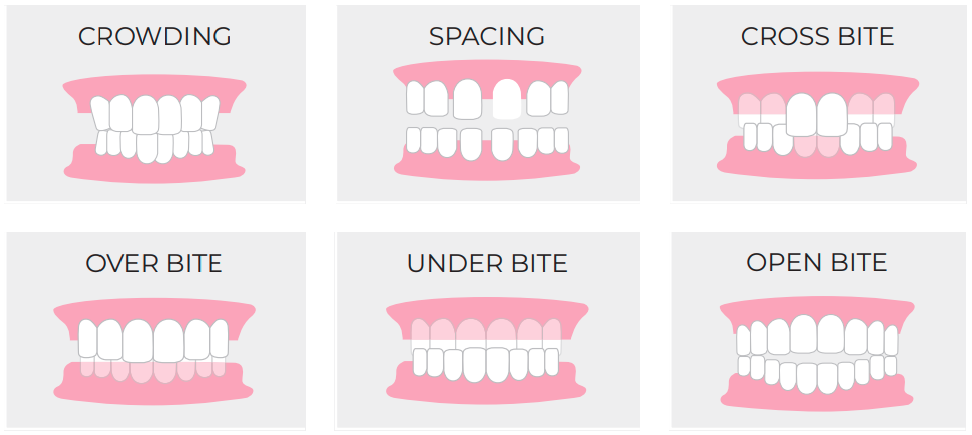 Cases of bad tooth conditions